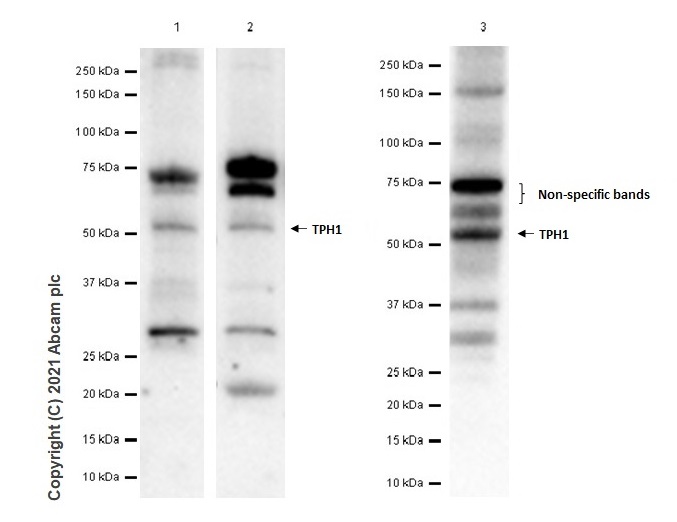 Western blot - Anti-Tryptophan Hydroxylase/TPH antibody [EP1311Y] (AB52954), expandable thumbnail