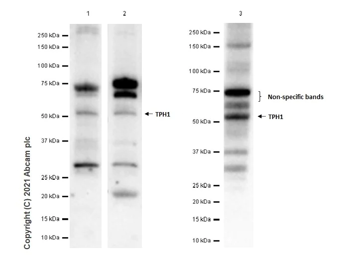 Western blot - Anti-Tryptophan Hydroxylase/TPH antibody [EP1311Y] (AB52954)