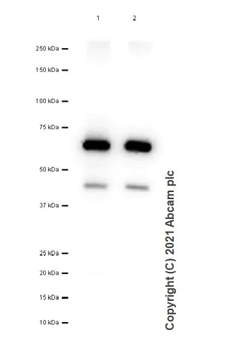 Western blot - Anti-Tryptophan Hydroxylase/TPH antibody [EP1311Y] (AB52954)