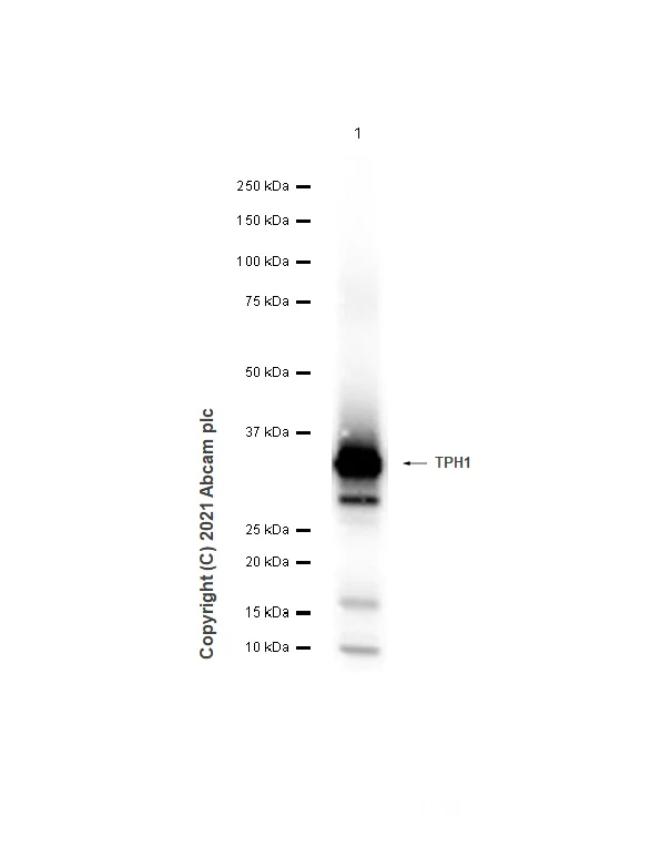 Western blot - Anti-Tryptophan Hydroxylase/TPH antibody [EP1311Y] - BSA and Azide free (AB227845)