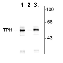 Western blot - Anti-Tryptophan Hydroxylase/TPH (phospho S260) antibody (AB30574)