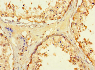 Immunohistochemistry (Formalin/PFA-fixed paraffin-embedded sections) - Anti-Tryptophan rich protein antibody (AB234748)