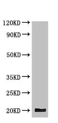 Western blot - Anti-Tryptophan rich protein antibody (AB234748)
