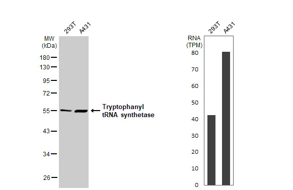 Western blot - Anti-Tryptophanyl tRNA synthetase antibody [HL2186] (AB317156)