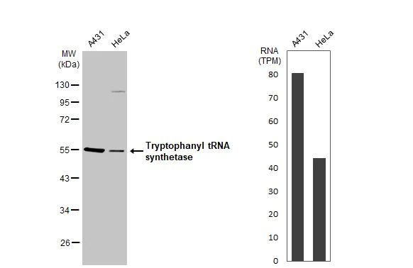 Western blot - Anti-Tryptophanyl tRNA synthetase antibody [HL2186] (AB317156)