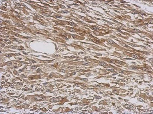 Immunohistochemistry (Formalin/PFA-fixed paraffin-embedded sections) - Anti-Tryptophanyl tRNA synthetase/WRS antibody (AB228724)