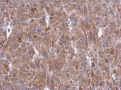 Immunohistochemistry (Formalin/PFA-fixed paraffin-embedded sections) - Anti-Tryptophanyl tRNA synthetase/WRS antibody (AB228724)