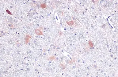 Immunohistochemistry (Formalin/PFA-fixed paraffin-embedded sections) - Anti-Tryptophanyl tRNA synthetase/WRS antibody (AB228724)