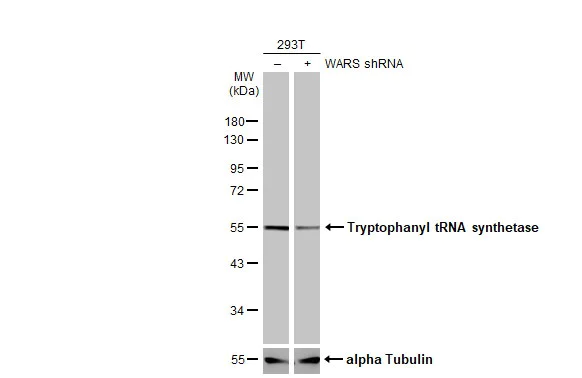 Western blot - Anti-Tryptophanyl tRNA synthetase/WRS antibody (AB228724)