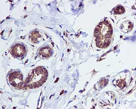Immunohistochemistry (Formalin/PFA-fixed paraffin-embedded sections) - Anti-Tryptophanyl tRNA synthetase/WRS antibody [EPR3423] - BSA and Azide free (AB247793), expandable thumbnail