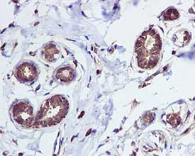 Immunohistochemistry (Formalin/PFA-fixed paraffin-embedded sections) - Anti-Tryptophanyl tRNA synthetase/WRS antibody [EPR3423] - BSA and Azide free (AB247793)