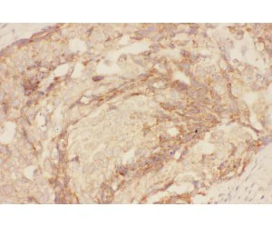 Immunohistochemistry (Formalin/PFA-fixed paraffin-embedded sections) - Anti-TSC-1 antibody (AB217328)