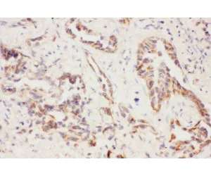 Immunohistochemistry (Formalin/PFA-fixed paraffin-embedded sections) - Anti-TSC-1 antibody (AB217328)