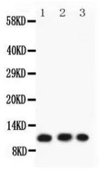 Western blot - Anti-TSC-1 antibody (AB217328)
