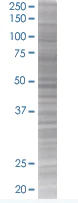 SDS-PAGE - TSC-1 overexpression 293T lysate (whole cell) (AB94221)
