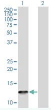 Western blot - TSC-1 overexpression 293T lysate (whole cell) (AB94221)