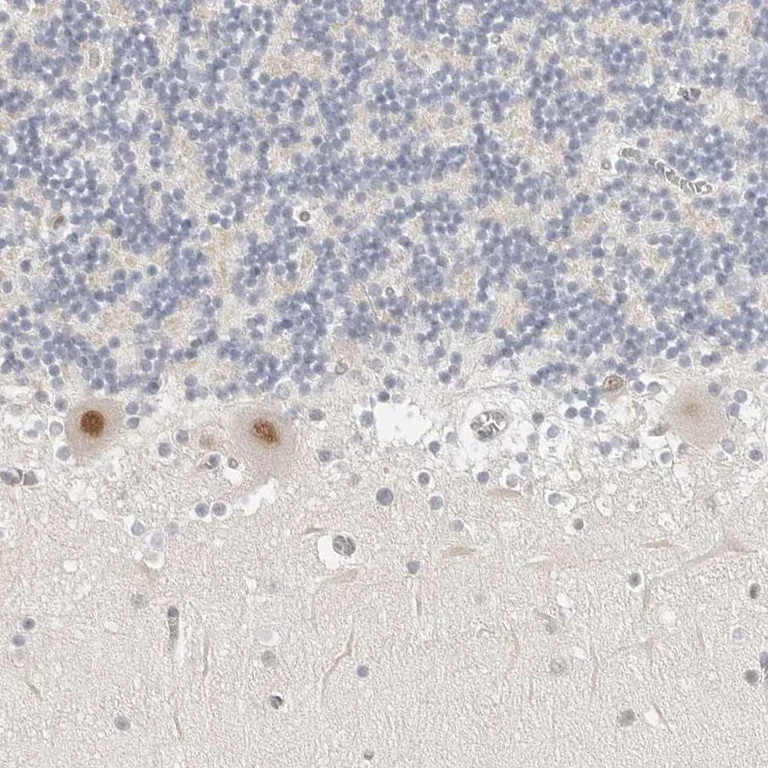 Immunohistochemistry (Formalin/PFA-fixed paraffin-embedded sections) - Anti-TSEN2 antibody (AB254711)