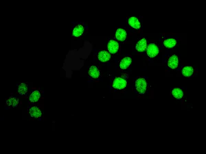 Immunocytochemistry/ Immunofluorescence - Anti-TSEN54 antibody [EPR10062] (AB178696)