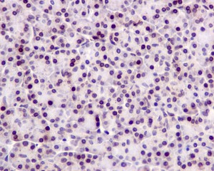 Immunohistochemistry (Formalin/PFA-fixed paraffin-embedded sections) - Anti-TSEN54 antibody [EPR10062] (AB178696)