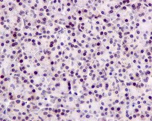 Immunohistochemistry (Formalin/PFA-fixed paraffin-embedded sections) - Anti-TSEN54 antibody [EPR10062] (AB178696)