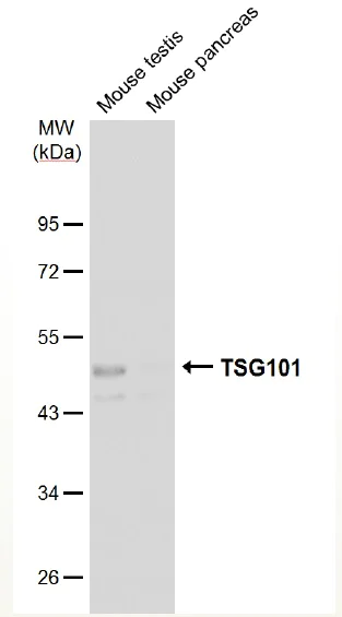 Western blot - Anti-TSG101 antibody [4A10] - BSA and Azide free (AB83)