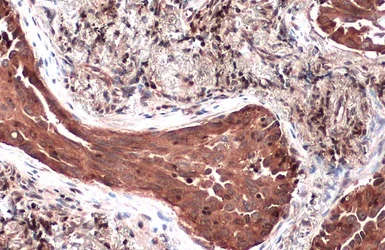 Immunohistochemistry (Formalin/PFA-fixed paraffin-embedded sections) - Anti-TSG101 antibody (AB228013)
