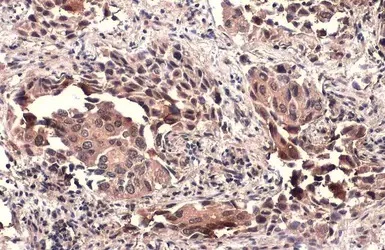 Immunohistochemistry (Formalin/PFA-fixed paraffin-embedded sections) - Anti-TSG101 antibody (AB228013)