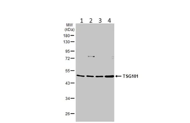 Western blot - Anti-TSG101 antibody (AB228013)