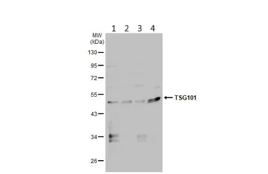 Western blot - Anti-TSG101 antibody (AB228013)