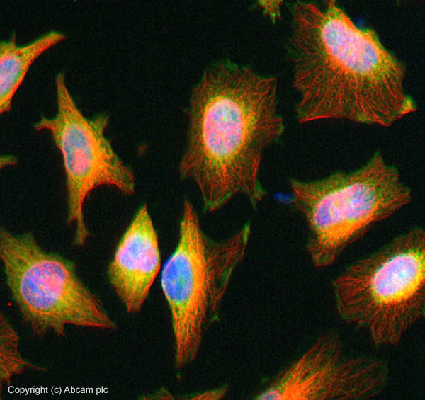 Immunocytochemistry/ Immunofluorescence - Anti-TSG101 antibody (AB30871)