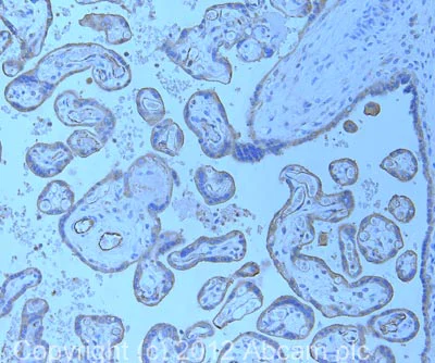 Immunohistochemistry (Formalin/PFA-fixed paraffin-embedded sections) - Anti-TSG101 antibody (AB30871)