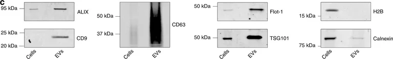 Western blot - Anti-TSG101 antibody (AB30871)