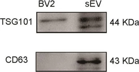 Western blot - Anti-TSG101 antibody (AB30871)