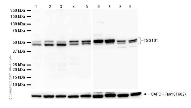 Western blot - Anti-TSG101 antibody [EPR7130(B)] (AB125011)