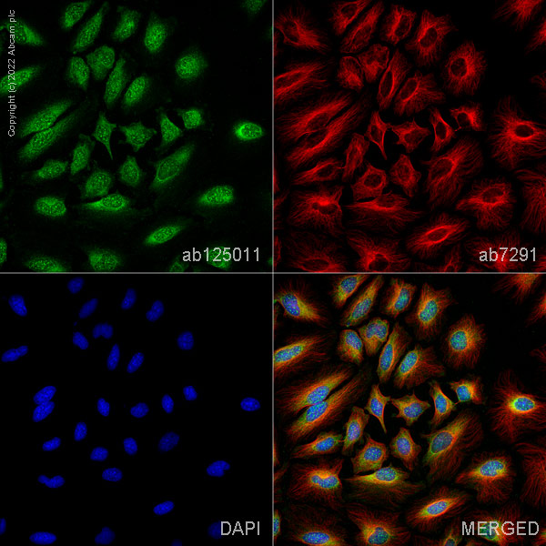 Immunocytochemistry/ Immunofluorescence - Anti-TSG101 antibody [EPR7130(B)] - BSA and Azide free (ab207567), expandable thumbnail