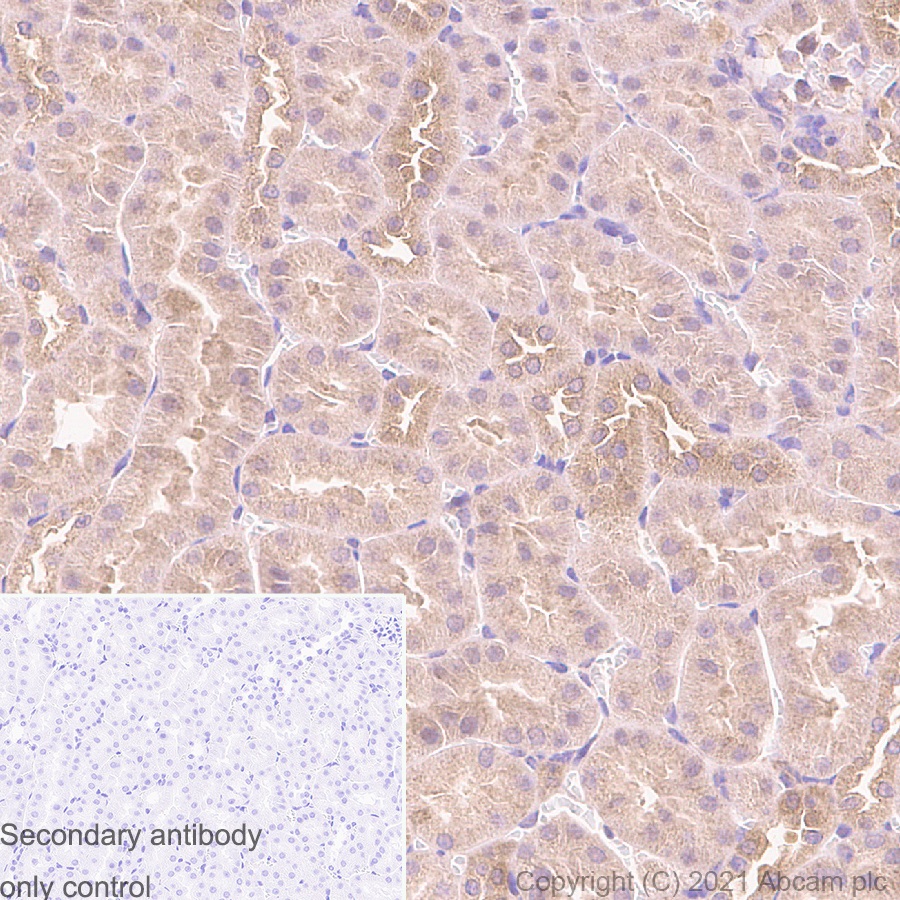 Immunohistochemistry (Formalin/PFA-fixed paraffin-embedded sections) - Anti-TSG101 antibody [EPR7130(B)] - BSA and Azide free (AB207567), expandable thumbnail