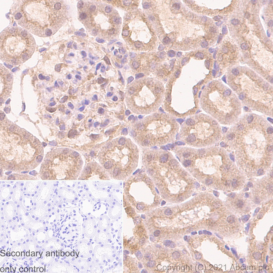 Immunohistochemistry (Formalin/PFA-fixed paraffin-embedded sections) - Anti-TSG101 antibody [EPR7130(B)] - BSA and Azide free (AB207567), expandable thumbnail