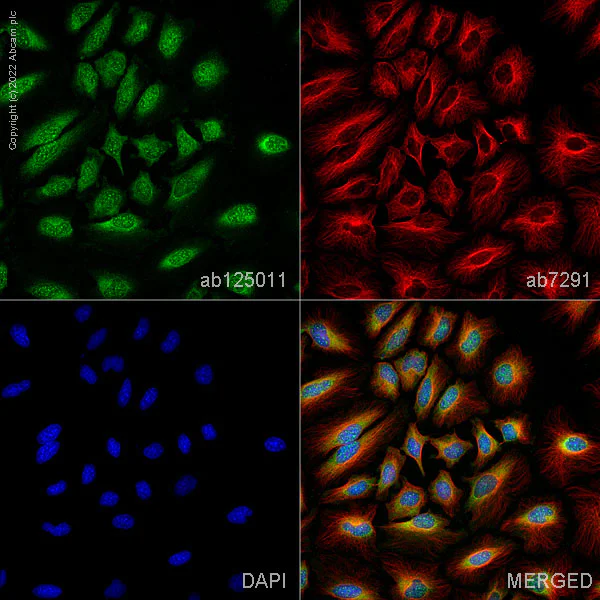 Immunocytochemistry/ Immunofluorescence - Anti-TSG101 antibody [EPR7130(B)] - Low endotoxin, Azide free (AB216447)