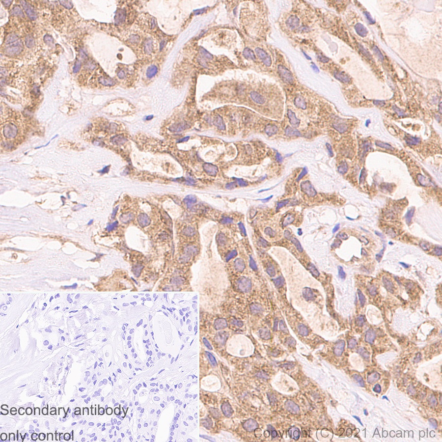 Immunohistochemistry (Formalin/PFA-fixed paraffin-embedded sections) - Anti-TSG101 antibody [EPR7130(B)] - Low endotoxin, Azide free (AB216447)
