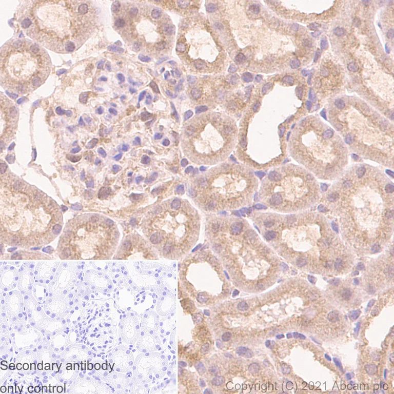 Immunohistochemistry (Formalin/PFA-fixed paraffin-embedded sections) - Anti-TSG101 antibody [EPR7130(B)] - Low endotoxin, Azide free (AB216447)