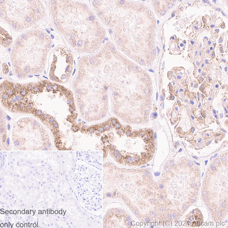 Immunohistochemistry (Formalin/PFA-fixed paraffin-embedded sections) - Anti-TSG101 antibody [EPR7130(B)] - Low endotoxin, Azide free (AB216447)