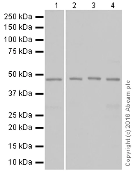 Western blot - Anti-TSG101 antibody [EPR7131(B)] (AB133586)
