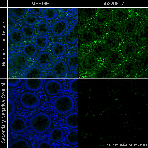Immunohistochemistry (Formalin/PFA-fixed paraffin-embedded sections) - Anti-TSG101 [EPR7130(B)] – Goat IgG (Chimeric) – BSA and Azide Free (AB320808)