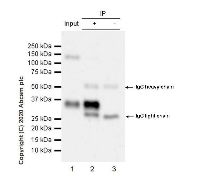 Immunoprecipitation - Anti-TSG6 antibody [EPR17582-45] - BSA and Azide free (AB274383), expandable thumbnail