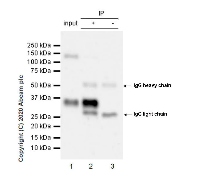Immunoprecipitation - Anti-TSG6 antibody [EPR17582-45] - BSA and Azide free (AB274383)