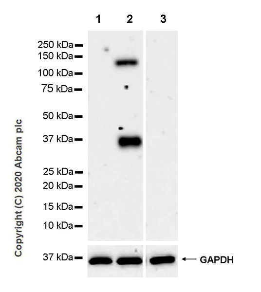 Western blot - Anti-TSG6 antibody [EPR17582-45] - BSA and Azide free (AB274383)