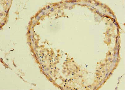 Immunohistochemistry (Formalin/PFA-fixed paraffin-embedded sections) - Anti-TSGA10 antibody (AB235313)