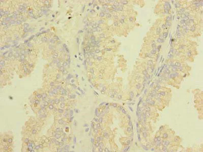 Immunohistochemistry (Formalin/PFA-fixed paraffin-embedded sections) - Anti-TSGA10 antibody (AB235313)