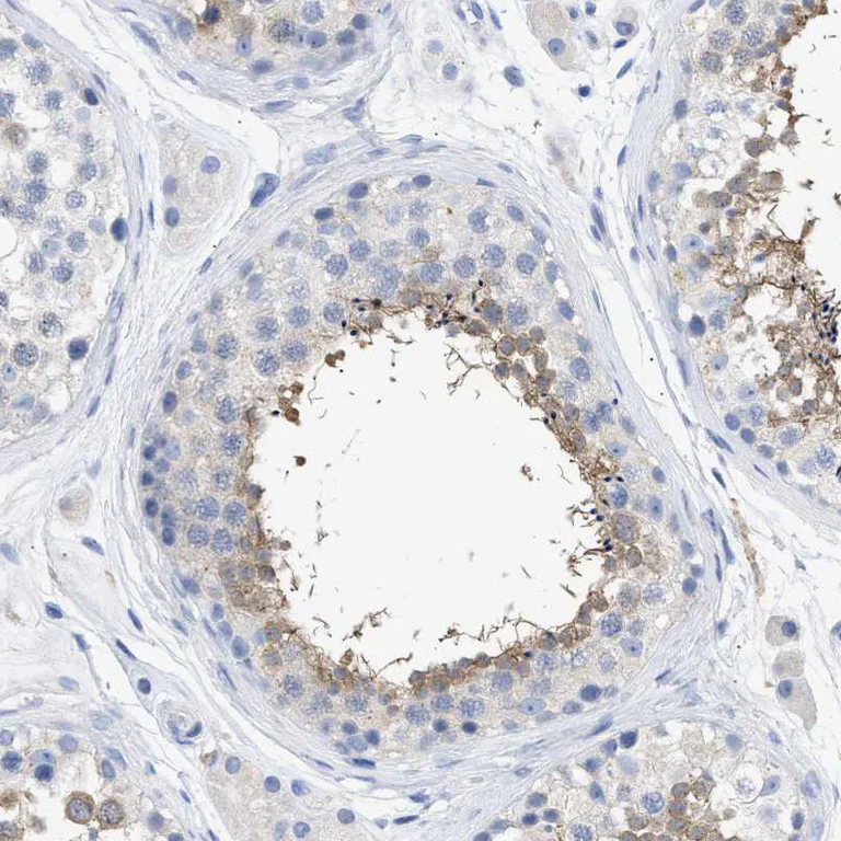 Immunohistochemistry (Formalin/PFA-fixed paraffin-embedded sections) - Anti-TSGA2 antibody (AB224104)