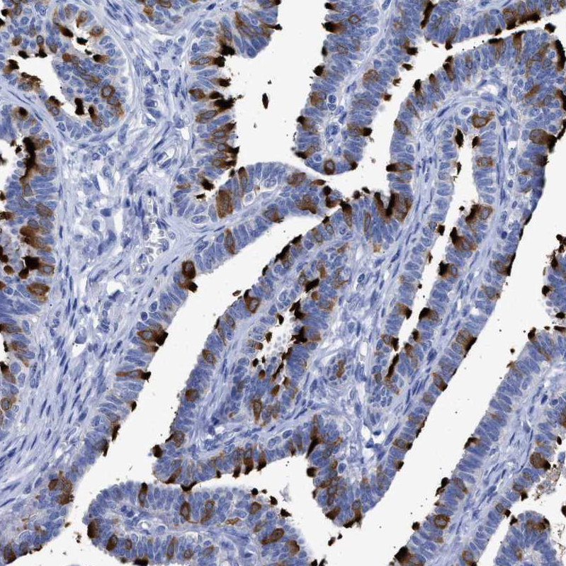 Immunohistochemistry (Formalin/PFA-fixed paraffin-embedded sections) - Anti-TSGA2 antibody (AB224104)